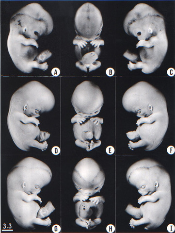 superficial vascular plexus