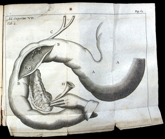 Linking Pancreas to Diabetic Symptoms