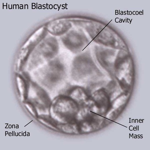 Blastocyst