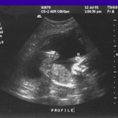 Timeline: Weeks 29-32, Pregnacy development of a baby
