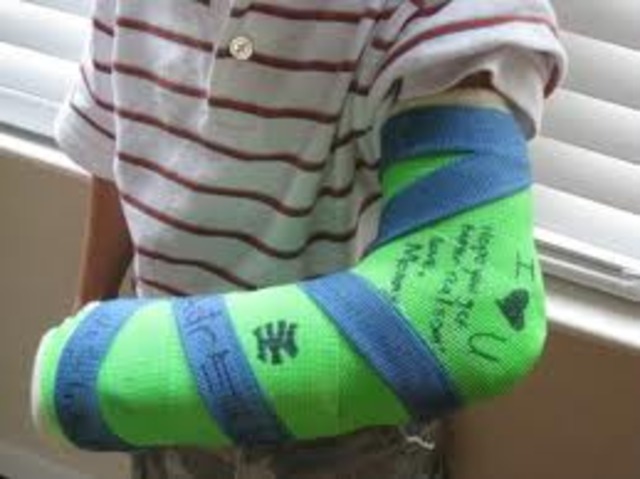 Broken Arm..