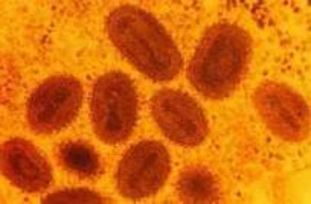 Small pox outbreak in winchestor