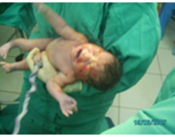 Nacimiento de mi 2do. bebé