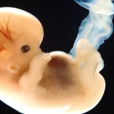 Timeline: Fetal Development