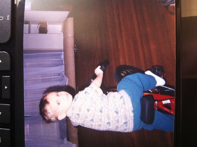 Knocked 4 front teeth out on a bicycle