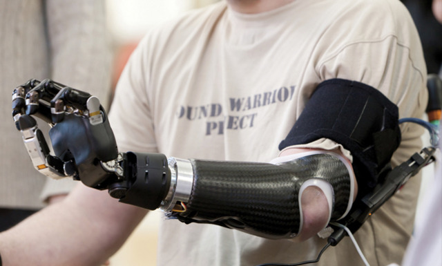 Τεχνητά μέλη