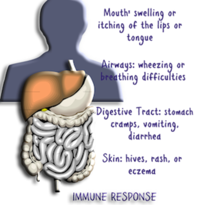 Timeline: Immune System Response to a Food Based Reaction