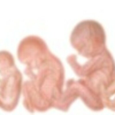 Timeline: Fetal Devolopment