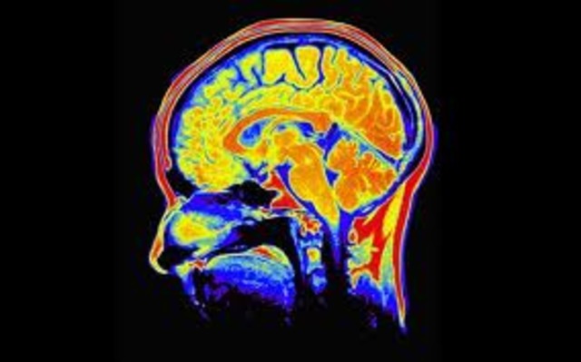 Nineteenth Century Progress