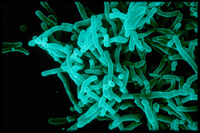 Pasteurization Developed