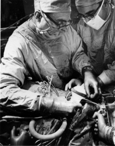 first artificial heart implant