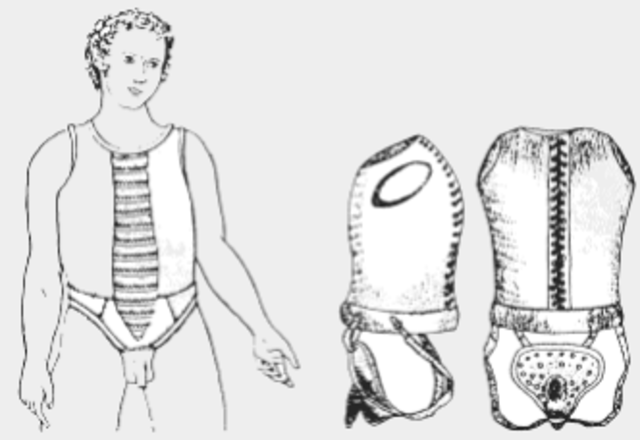 Artefactos metálicos anti-masturbación.