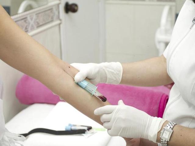 A Mis 20 Estoy Terminando Mi Carrera De Bacteriologia