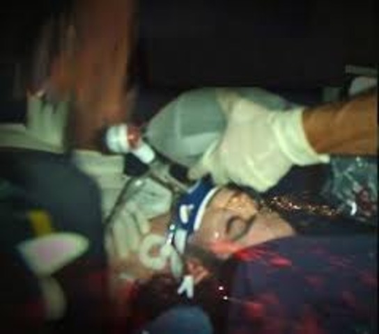 Micheal Jackson died