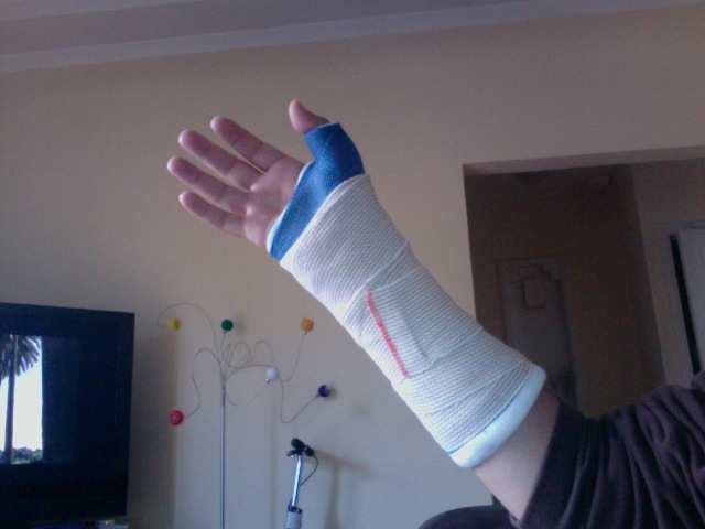 mi sono roto il polso