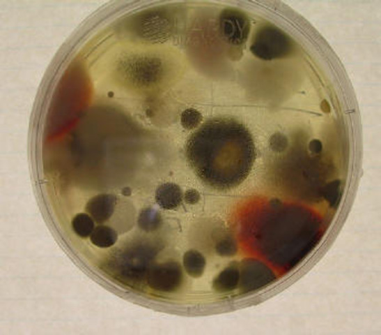 Mouldy Bacteria