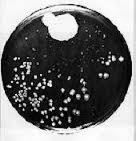Penicillium Notatum