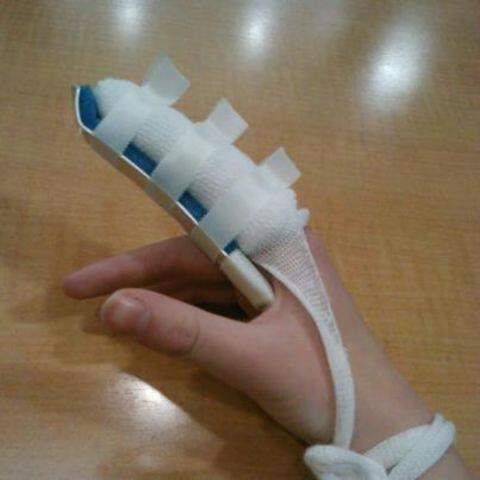 injuries that i have had happen