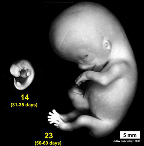 After Conception part II