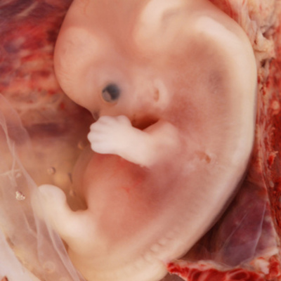 Timeline: Fetal Development Timeline