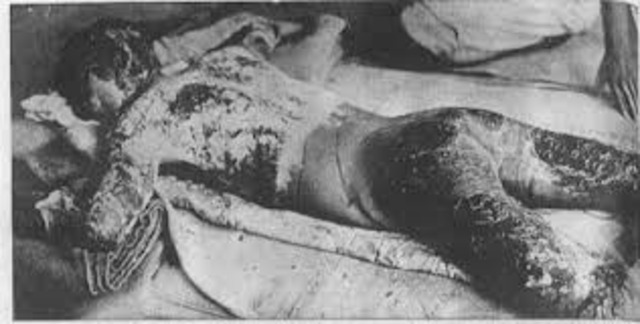 Second Bombing in Nagasaki