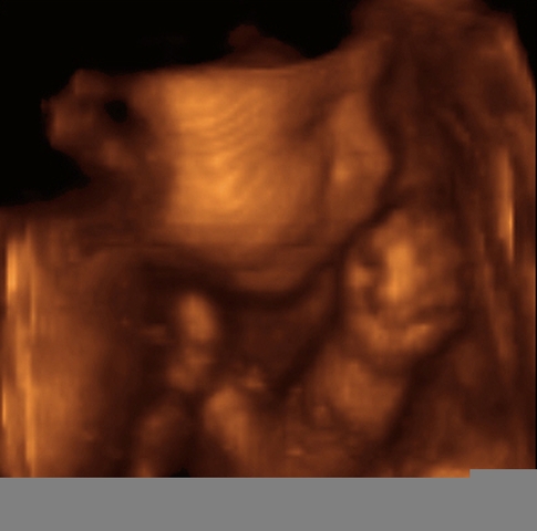 nacimiento de hermana