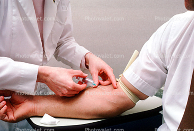 Cancer biomarkers - Predicting the likelihood of tumor spread.