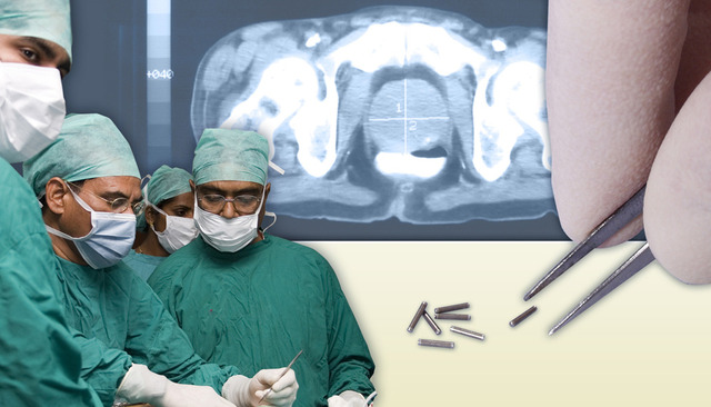 Isoray medical cancer treatment