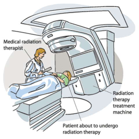 2nd Treatment Radiation
