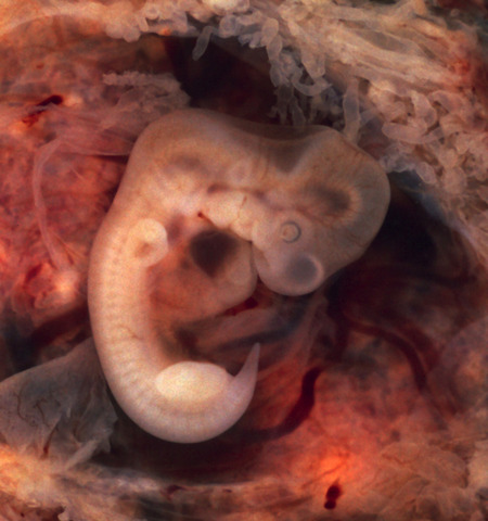 Implantation (Embryo)