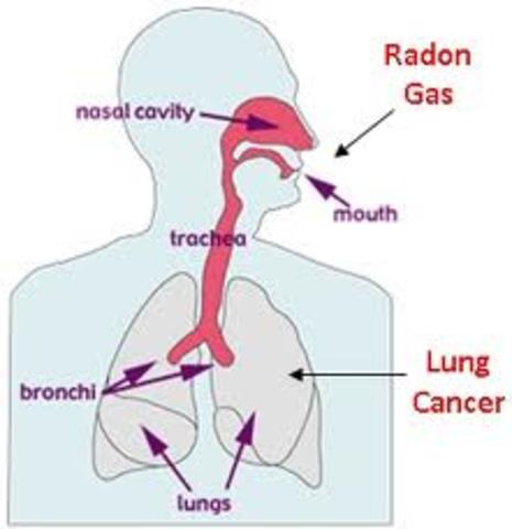 Radon's first use in medicine.