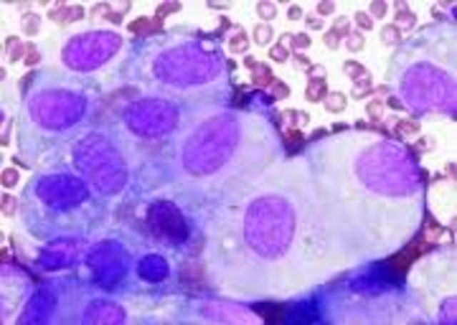 Urinary cytology, the examination of cells and other materials in urine, was used by George N. Papinicolaou and Victor F. Marshall to diagnose cancer of the bladder.