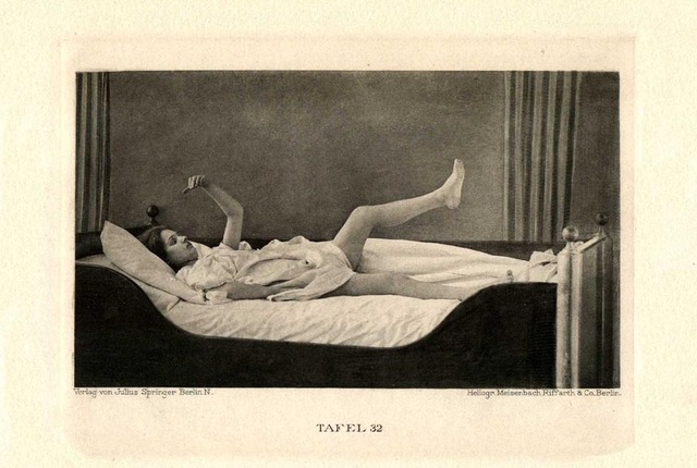 Teresa is diagnosed with catalepsy