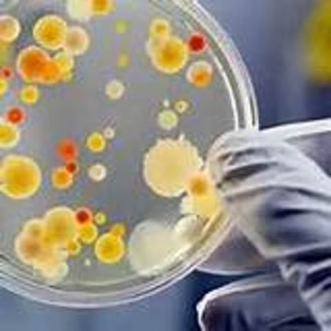 APARICION DE LA MICROBIOLOGIA