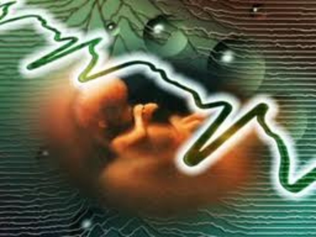 Fetal Heartbeat- Week 18 to 20