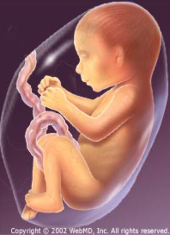 Fetus during week 32