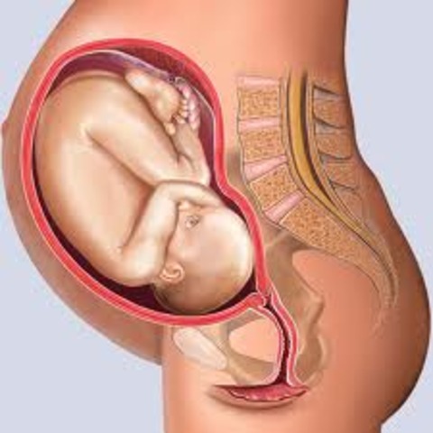 Fetus Growth Complete-Week 32