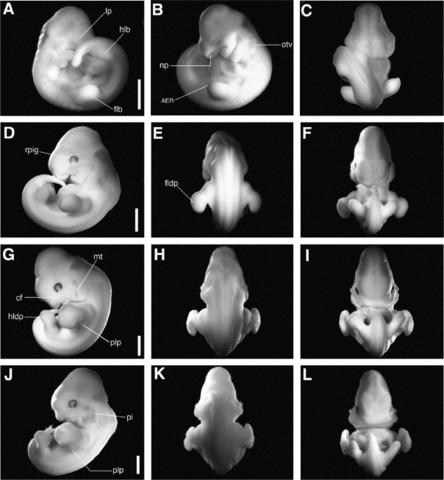 Prenatal Development- Embryonic Stage