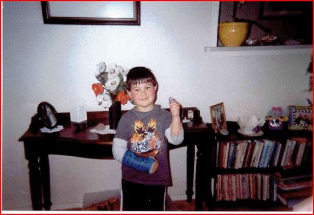 broke my arm for the firs time