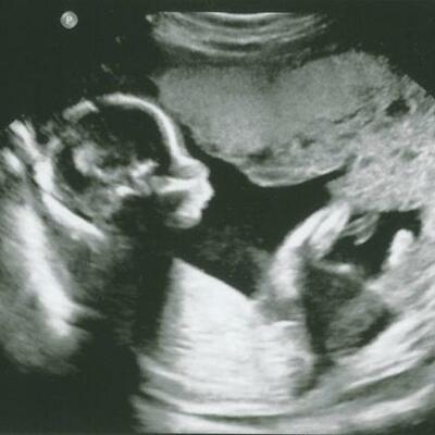 Timeline: My Pregnancy