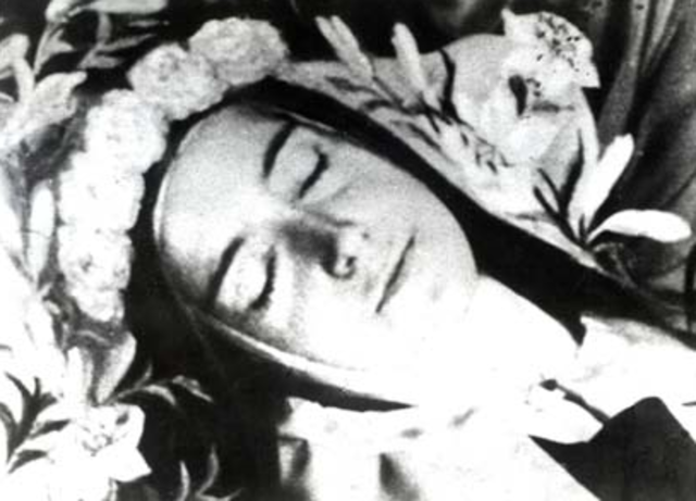 She fell ill with malarya and fell into a coma.