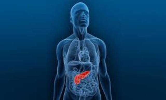 steve jobs es tratado por la enfermedad del cancer de pancreas