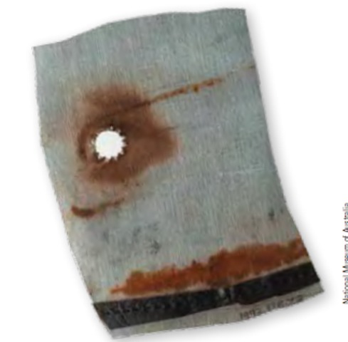 Blood Is Said To Be Fetal