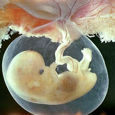Timeline: Fetal Development
