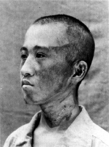 Radiation from Hiroshima