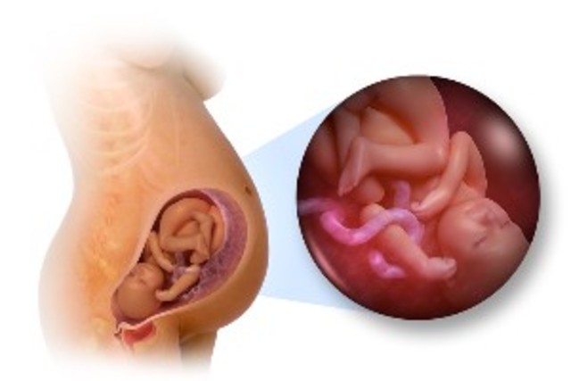 Week 36 of pregnancy