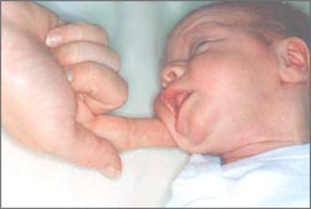 Reflex- Rooting Reflex