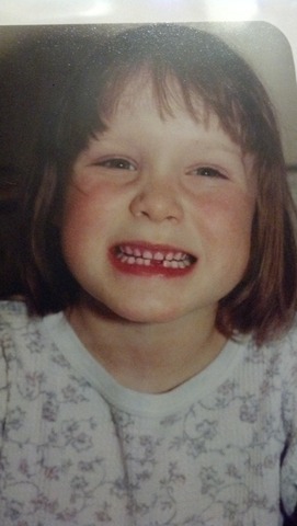 Perdi mi diente primer.