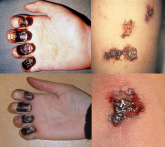 World Population at the time of The Bubonic Plague = 443 Million