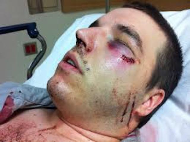 After Santiago gets beat up